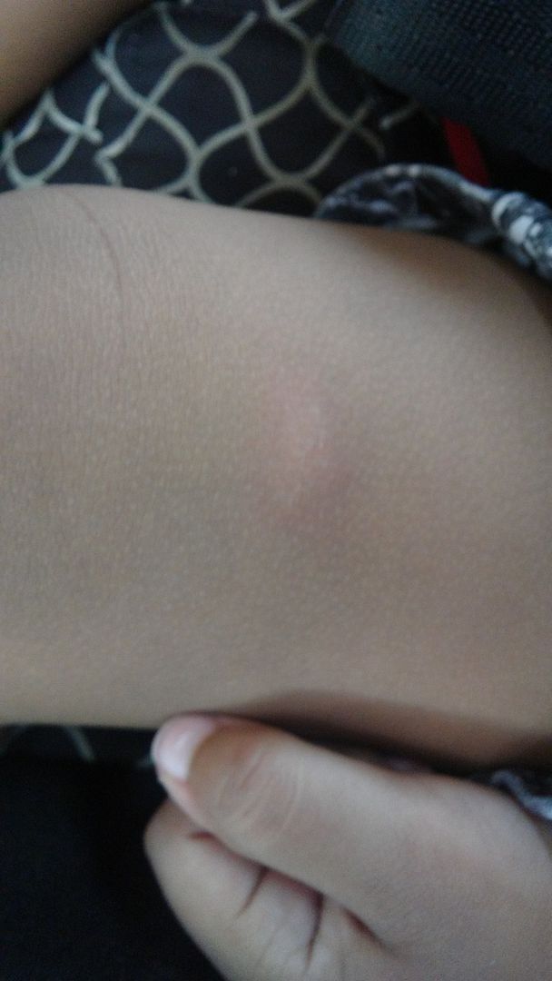 Herpes Forum Support Group Online for HSV